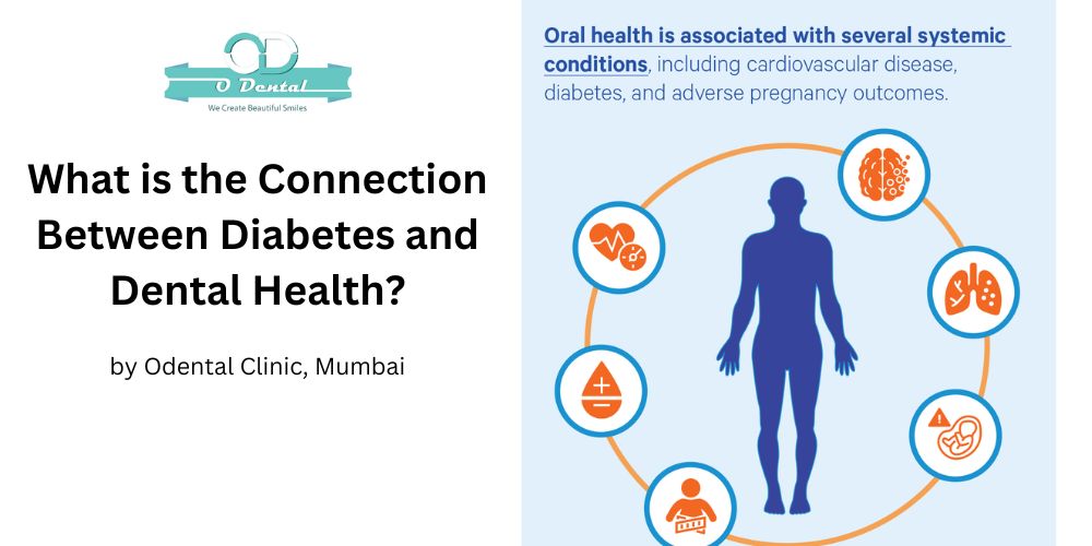 diabetes and dental health