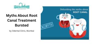 myths about root canal treatment