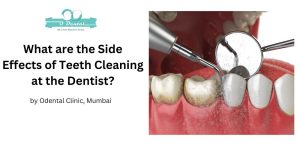 What are the side effects of teeth cleaning
